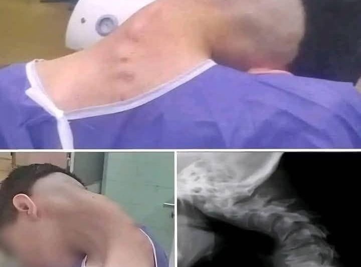 Young man hospitalized because he dropped his ca!