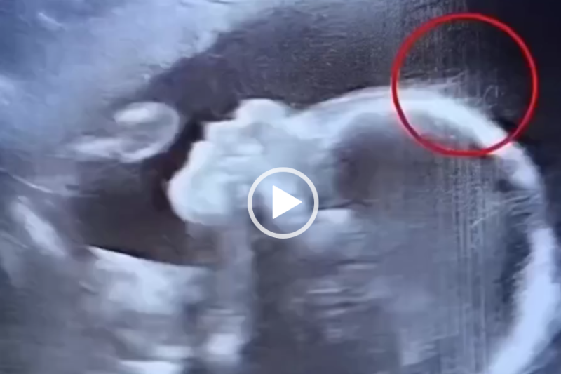 Doctors couldn’t believe what they saw during the ultrasound